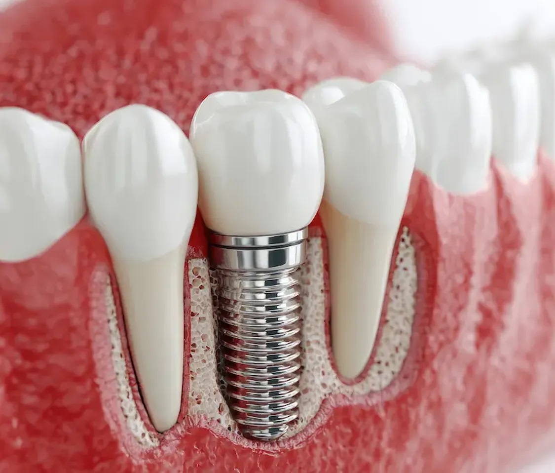 Dentist Supports